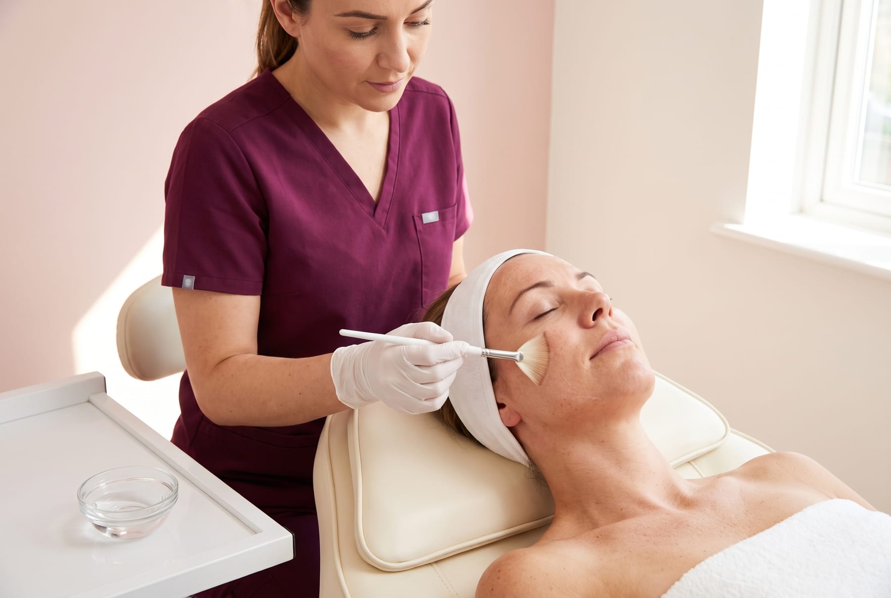 Chemical Peel