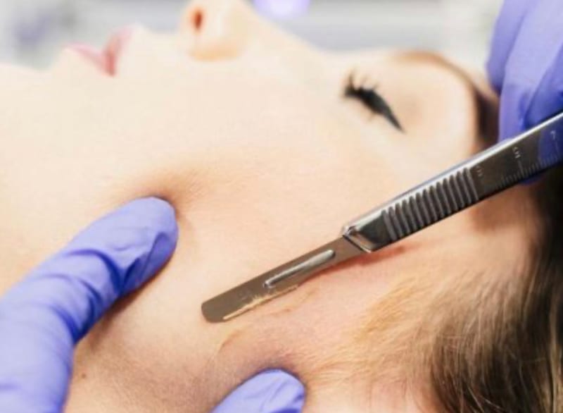 Dermaplaning at Avismo Aesthetics and Skin, St Ives