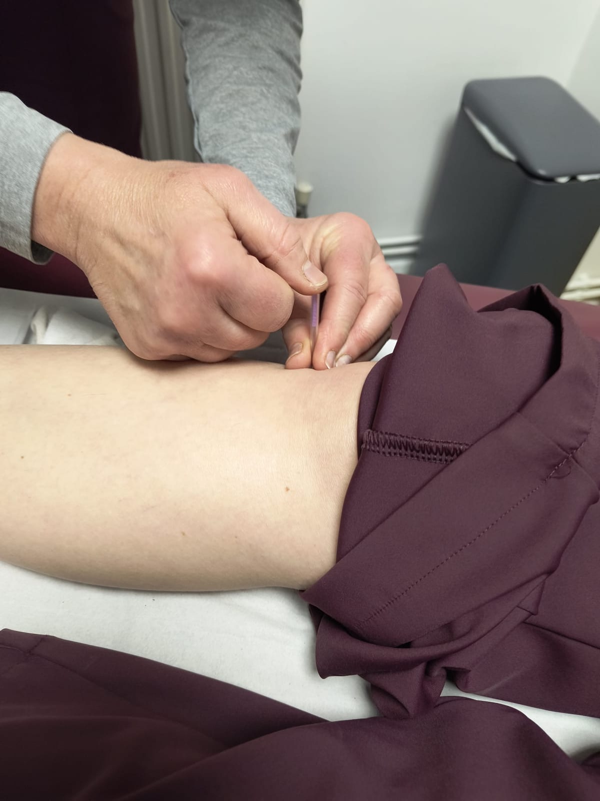 Medical acupuncture at Avismo Aesthetics and Skin, St Ives