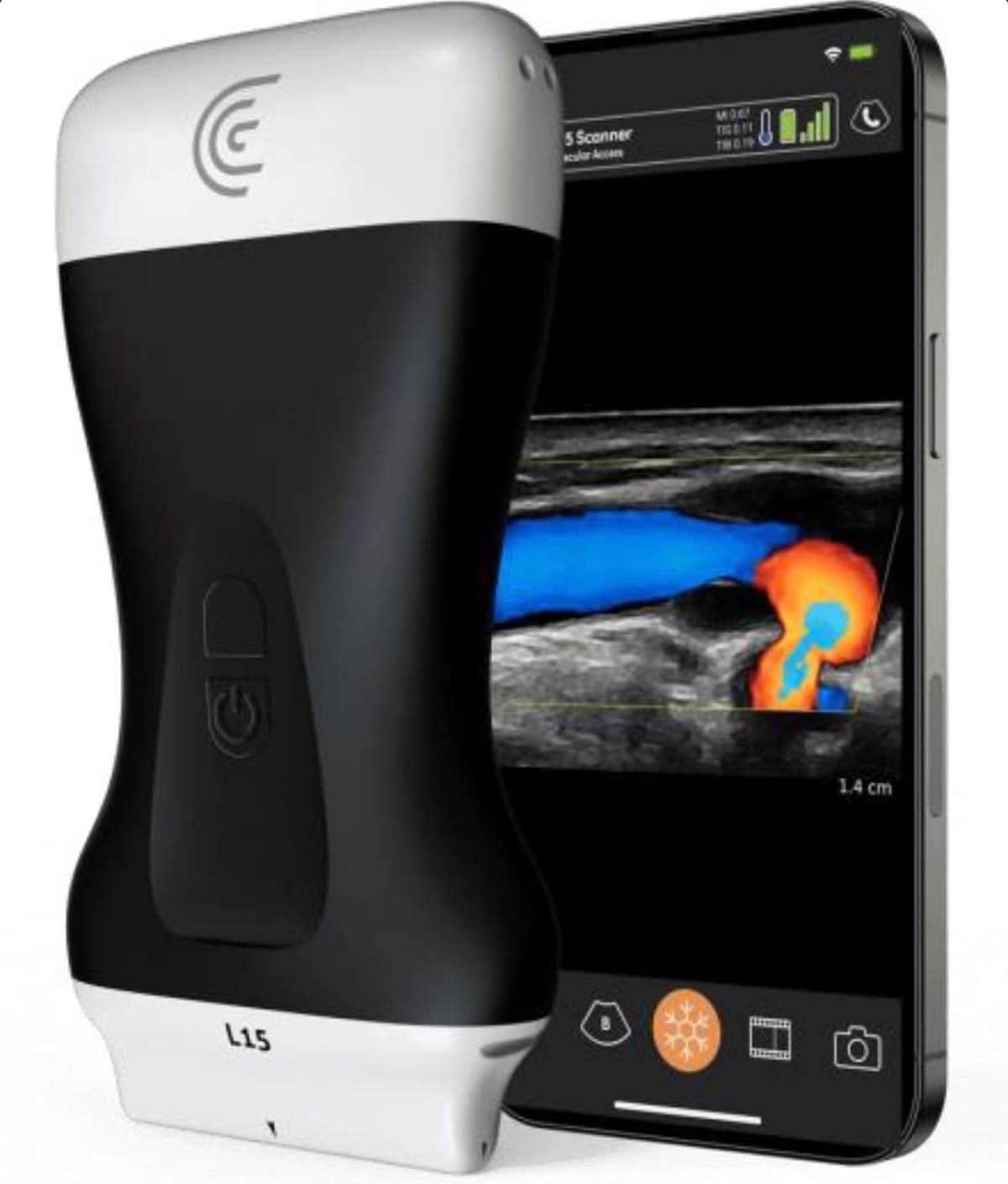 The Clarius L15 handheld ultrasound scanner, with a colour Doppler image of blood vessels on screen