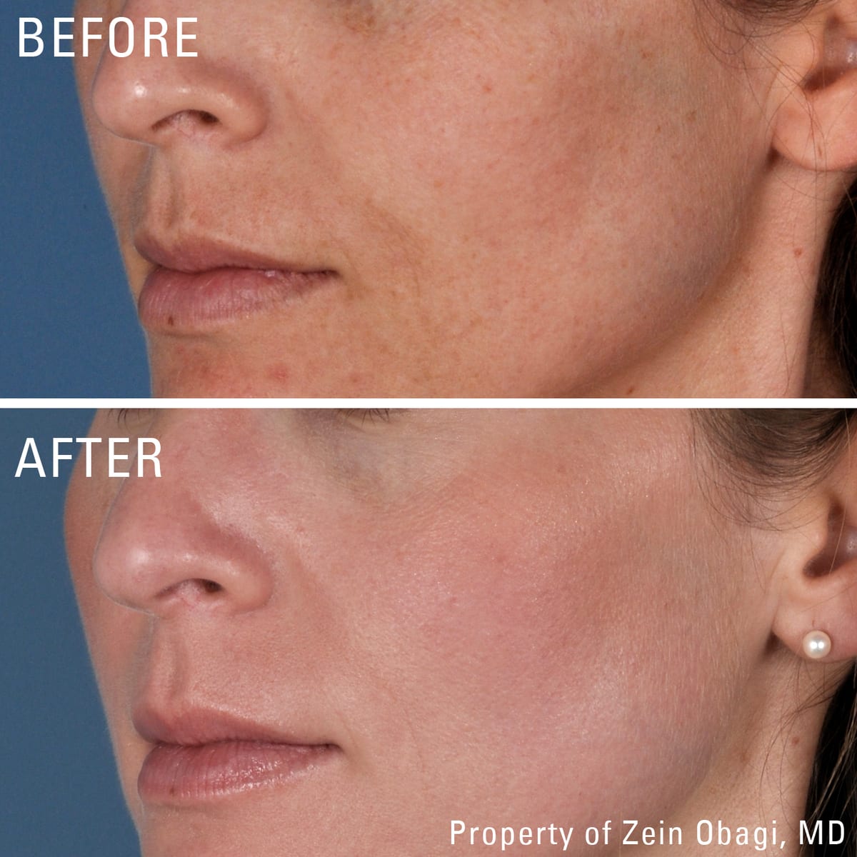 ZO Skin Health for signs of ageing