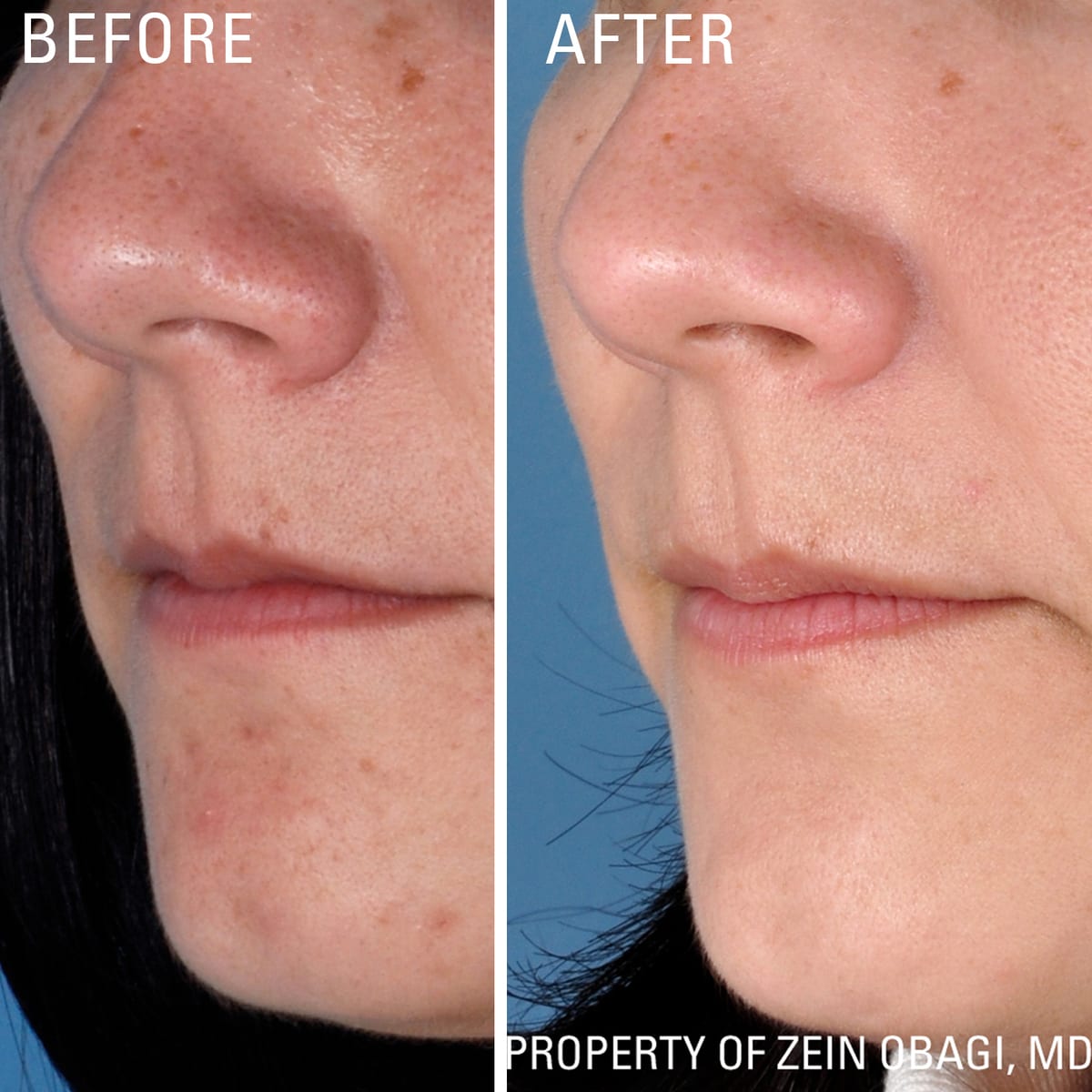 ZO Skin Health for redness and rosacea